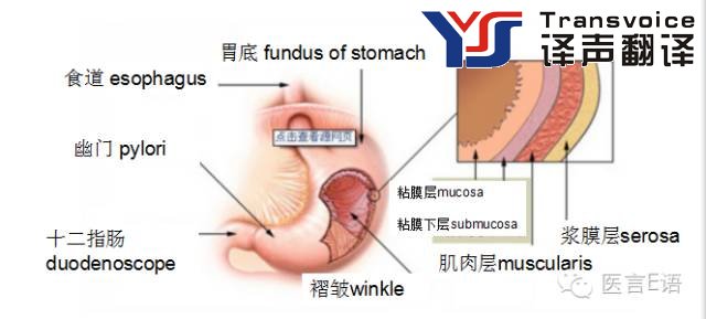 醫(yī)學(xué)翻譯：消化科——胃癌(圖2)